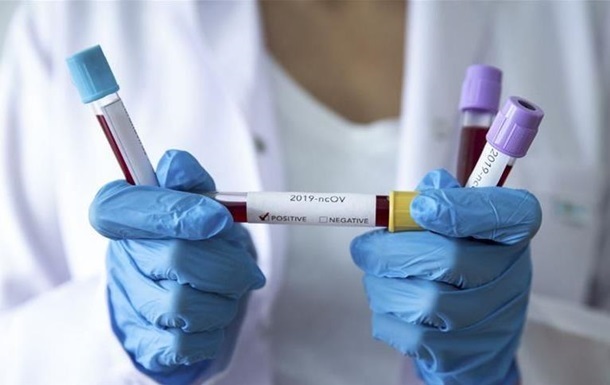 Новость - События - Эпидемия коронавируса: в МОЗе рассказали о тест-системах и как они работают