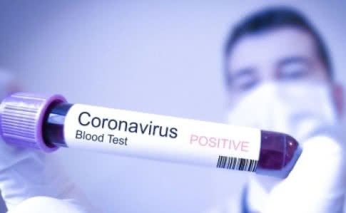 Новость - События - Украинка заболела коронавирусом в Италии: МИД сообщил о состоянии женщины