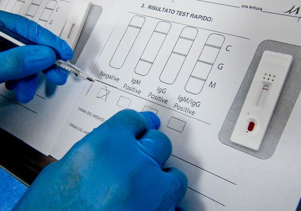 Фото: EPA-EFE/CIRO FUSCO. Определение результатов тестов на коронавирус. 