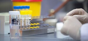 На Полтавщине увеличивают количество анализов: запускают еще 7 иммуноферментных лабораторий