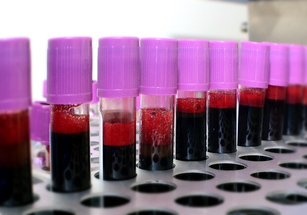 Как быть донором: где в Днепре сдать кровь