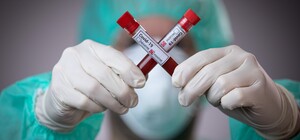 Заболела треть общежития: вспышка коронавируса в КПИ