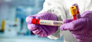 Коронавирус в Полтаве: 7 августа подтвердили новые диагнозы