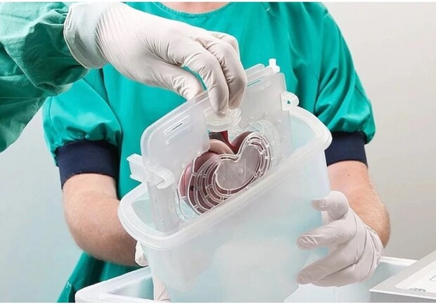 В Украине заработала система по вопросам трансплантации органов. Фото: delo.ua