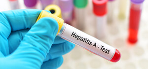 Вспышка гепатита: в Одесской области заболели воспитанники детского дома