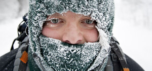 Чекають на ампутацію: на вихідних через обмороження госпіталізували сімох львів'ян