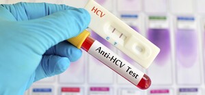 Бесплатно: где и когда в Полтаве пройти тестирование на гепатит С