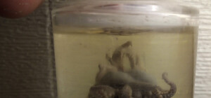 Аптечка и столетний осьминог: что нашли археологи в центре Одессы