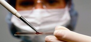 В Одессе можно будет бесплатно сдать тест на ВИЧ и гепатиты 