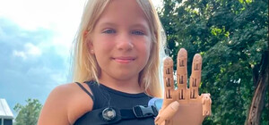 9-річній Саші, яка втратила руку під час обстрілів Бучі, встановили протез