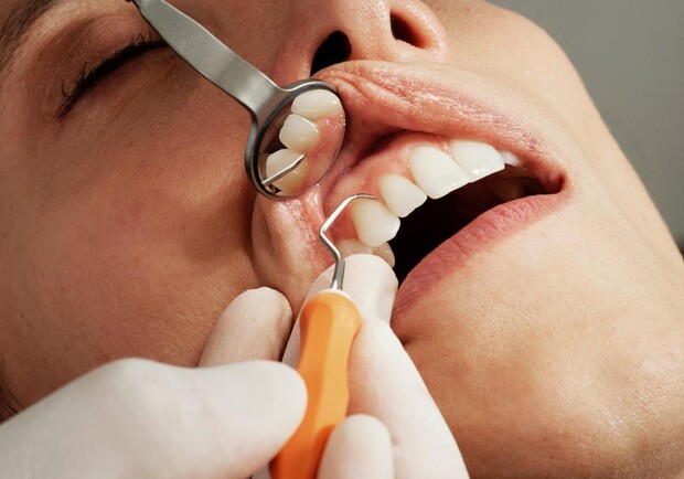Когда нужно идти к стоматологу: с какими зубными проблемами необходимо обратиться к врачу-специалисту - фото