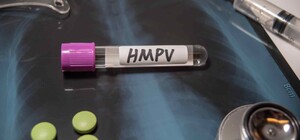 Метапневмовирус HMPV в Запорожье: что известно о ситуации в регионе