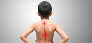 В Одесі дітям можна безкоштовно обстежити опорно-руховий апарат: де та коли