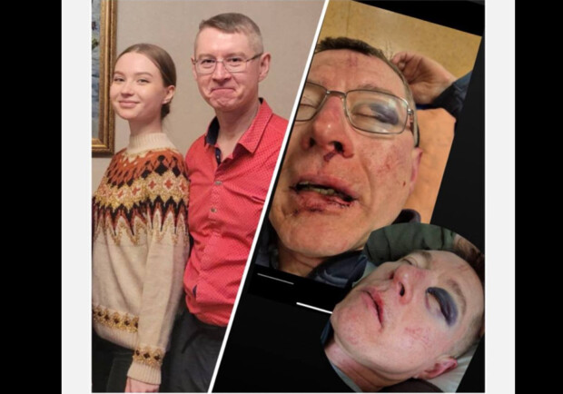Жорстоке затримання у парку Києва: батько отримав перелом очниці та крововилив у мозок 