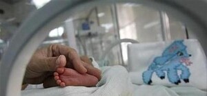 У донецких сиамских близнецов одно сердце на двоих. Детки погибнут?