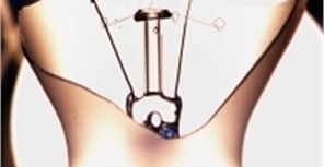 В Крыму ураган оставил без газа и света целый район