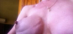 Медики игнорируют жертву луганских пластических хирургов