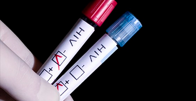 Результаты экспресс-теста будут готовы уже через 15 минут. Фото с сайта <a href="http://mediad.publicbroadcasting.net/p/innovationtrail/files/201303/HIV-Test2.jpg">mediad.publicbroadcasting.net</a>.