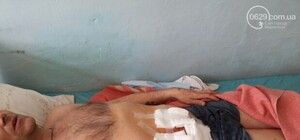 Штурмующие воинскую часть в Мариуполе “подсвечивали” себе коктейлями Молотова: пострадавший о перестрелке