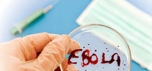 Что будет, если в Днепропетровск придет Эбола