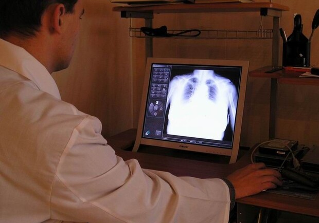 Новость - События - Во вторник на Соломенке можно будет бесплатно провериться на туберкулез