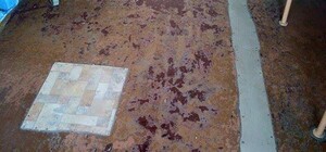 Лікарняний 