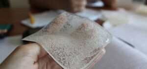 Львівські вчені розробили унікальну пов’язку, яка швидко загоює рани