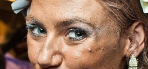 Страшнее ночи: ТОП-5 самых жутких последствий похода к косметологу в Днепре