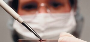 Не опять, а снова: в Харьков завезли опасную болезнь