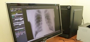 Коли запрацюють: в лікарнях Львова встановлюють сучасні рентген-апарати