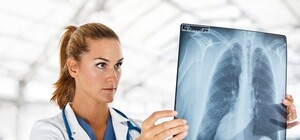 Береги здоровье: в центре Симферополя будет бесплатно работать флюорограф