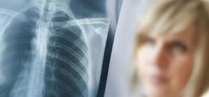 Просветись: где в Киеве можно бесплатно сделать флюорографию