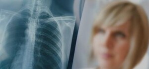 Где в Киеве можно бесплатно в феврале пройти флюорографию. Адреса