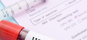 В Симферополе можно пройти бесплатный тест на ВИЧ: где и когда