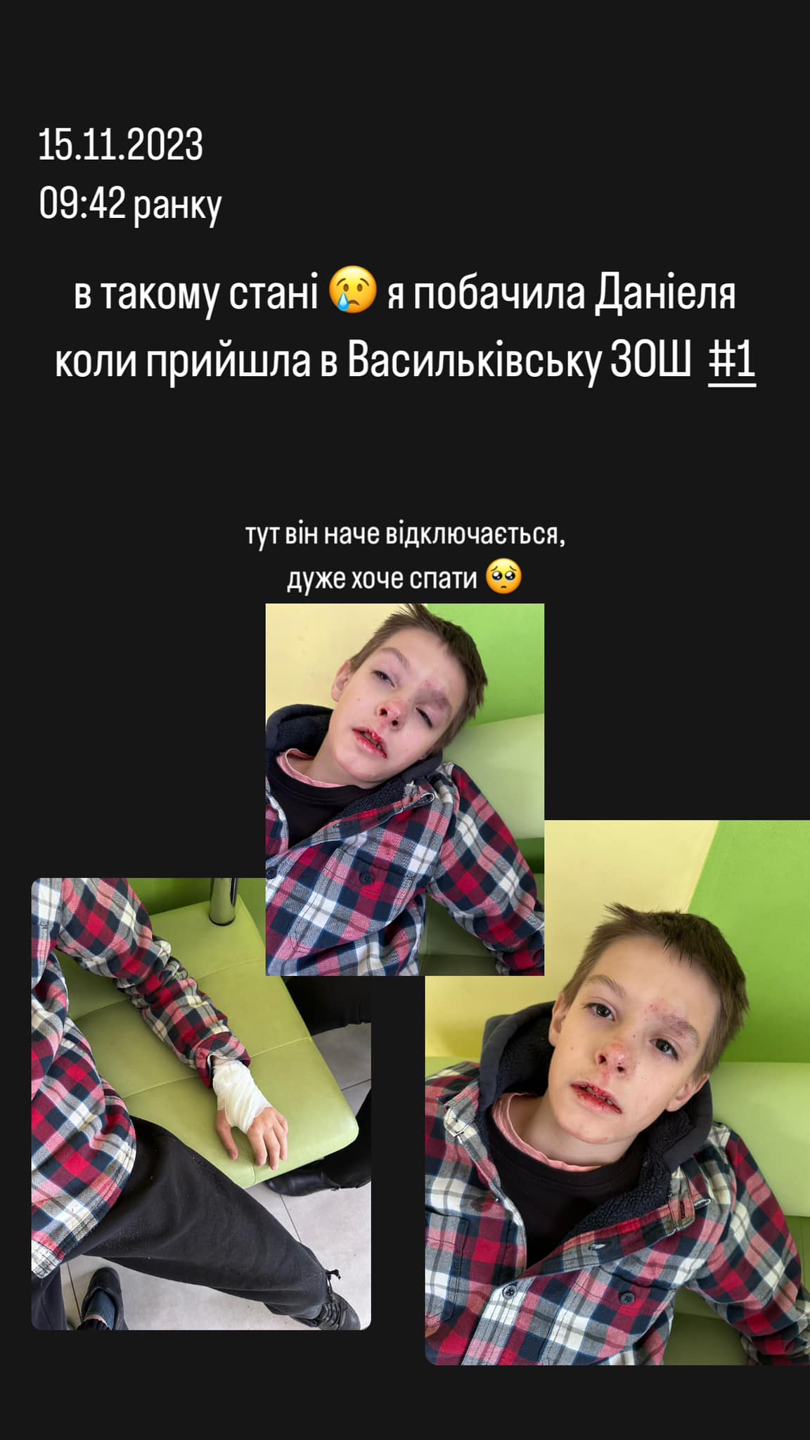 У Васильківській гімназії дитину скинули з висоти -