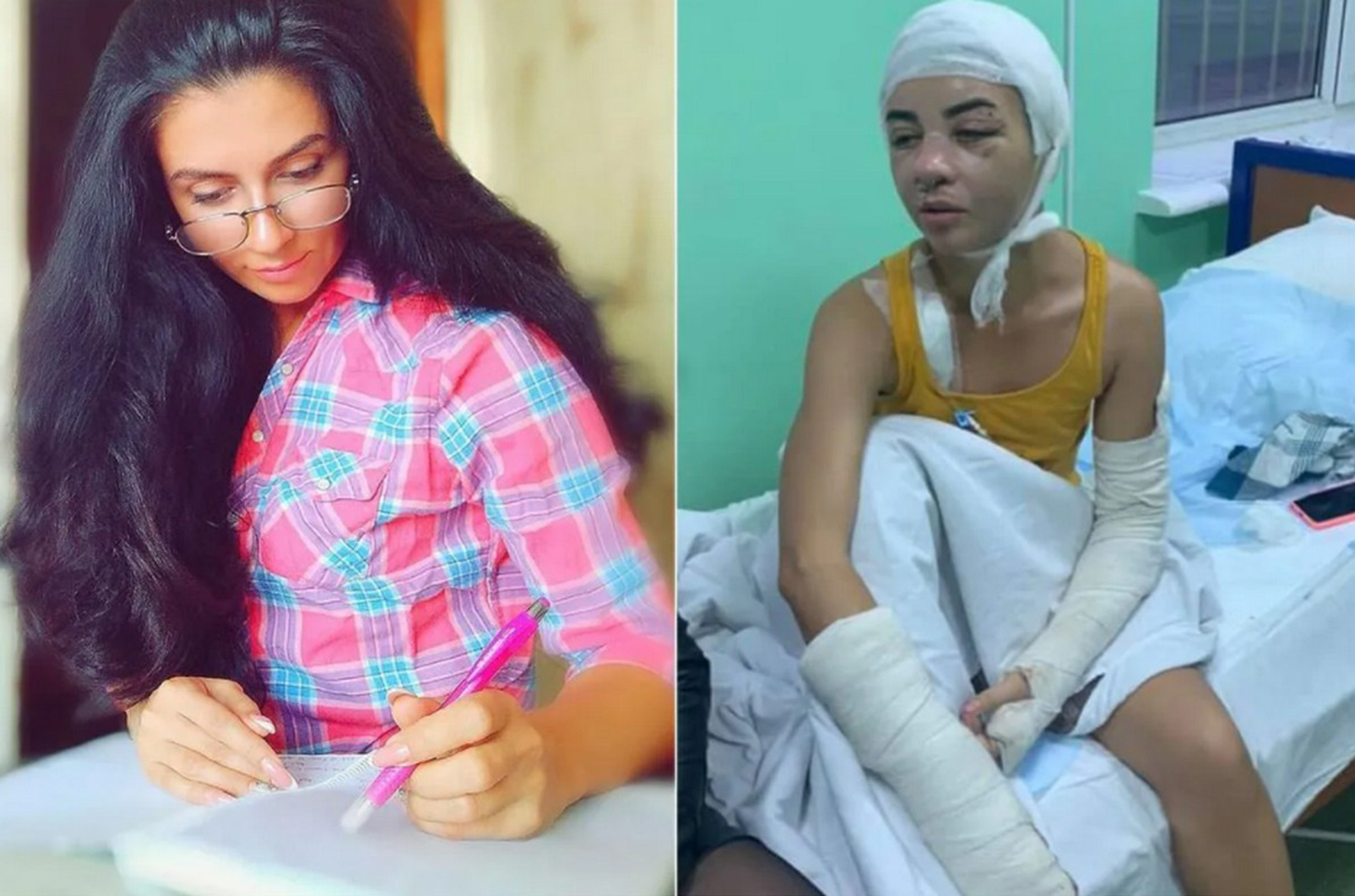 Ольга до и после побоев. Фото: факты