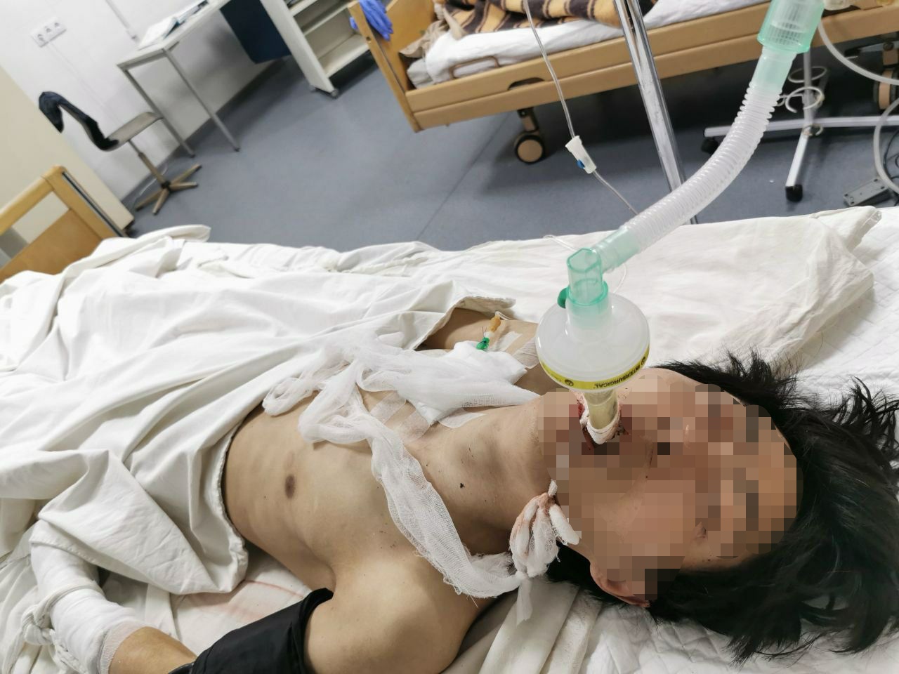 Пострадавший. Фото: Киевская областная прокуратура