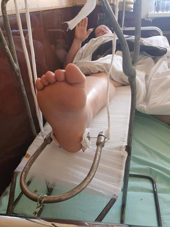 Руслана Писанка зламала ногу на сцені київського театру.