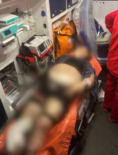 Під Києвом жінка підірвалася на міні під час прогулянки лісом фото 2 1