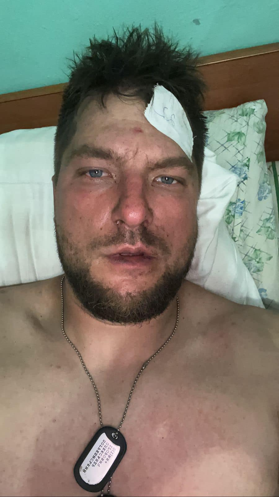 На фронте получил контузию депутат Киеврады Александр Погребинский.