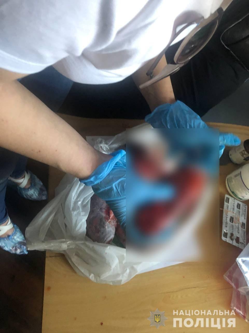 Під Києвом учасник ток-шоу вбив та розчленував кохану