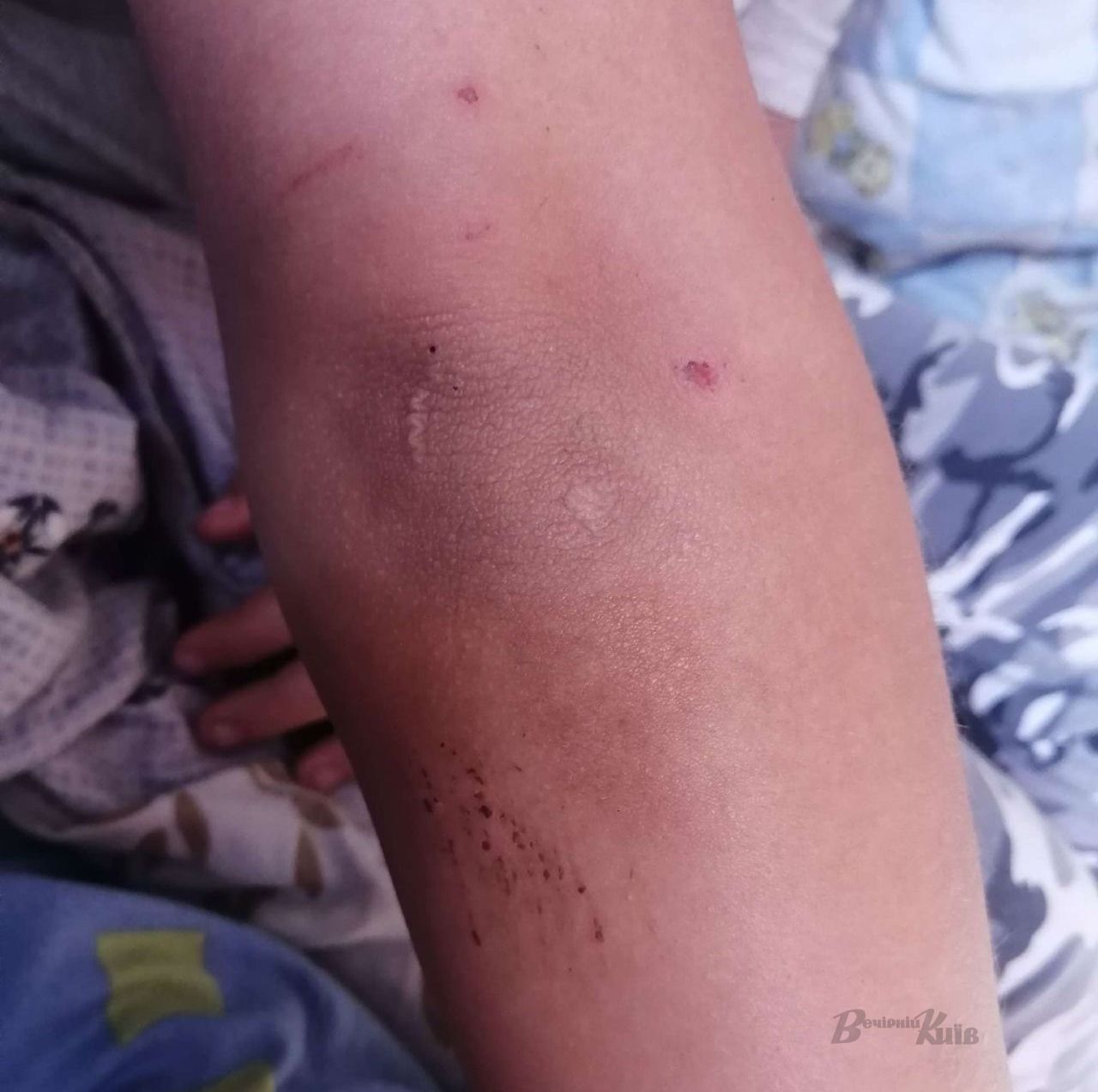 Жестко наказал: в Киеве учителя обвиняют в избиении пятиклассника фото 1