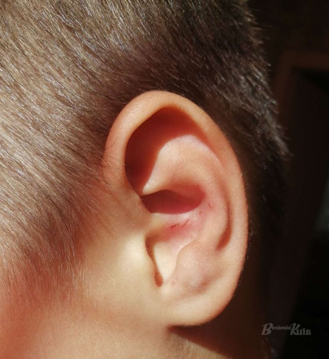 Жестко наказал: в Киеве учителя обвиняют в избиении пятиклассника фото 2 1