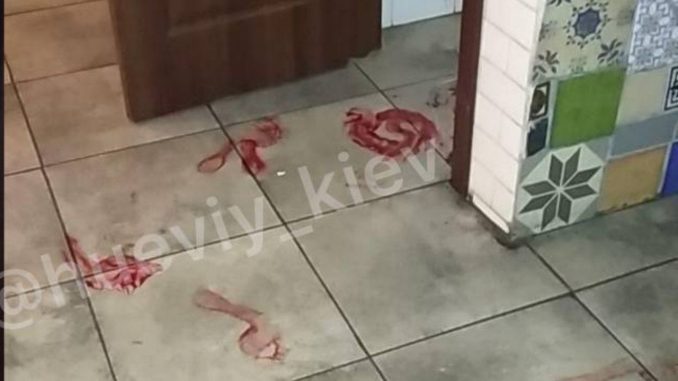 Опасный интим: в Киеве в пиццерии девушка чуть не откусила мужчине половой орган фото 2 1