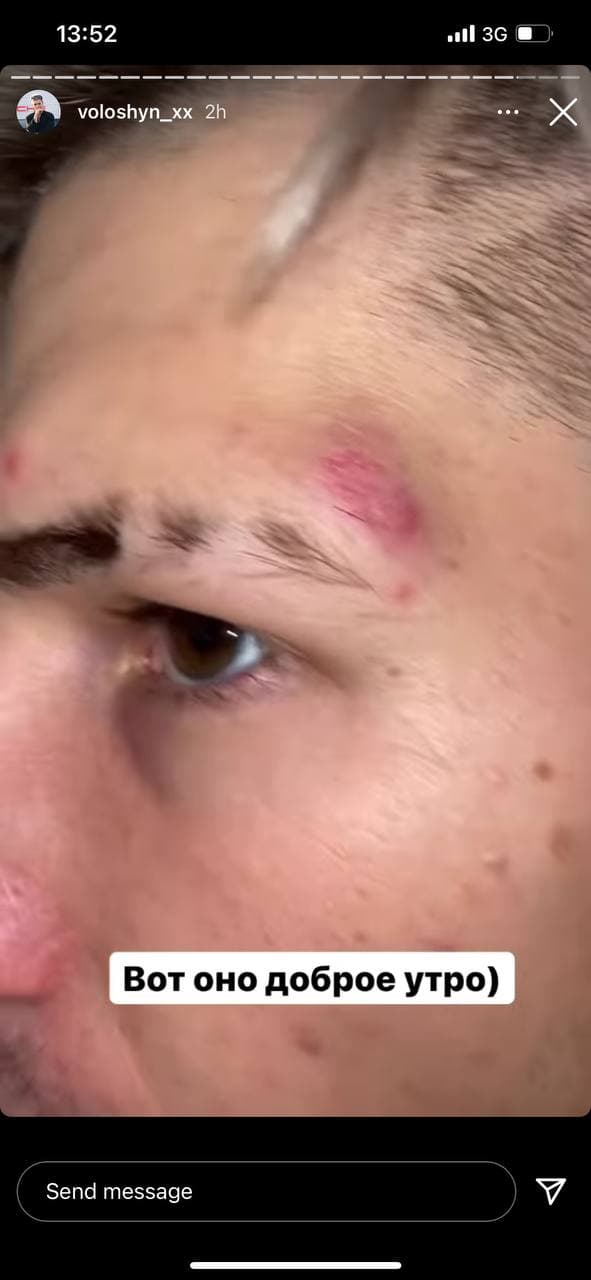 Задержание блогера. Фото: телеканал "Киев"