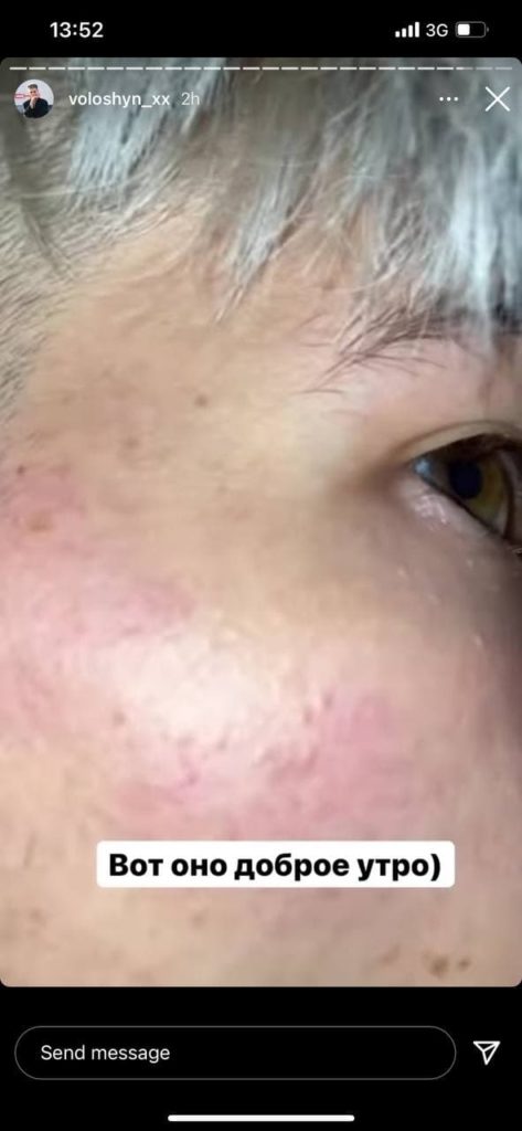 Задержание блогера. Фото: телеканал "Киев"