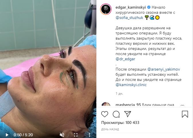 Софии Стужук сделали пластическую операцию в прямом эфире