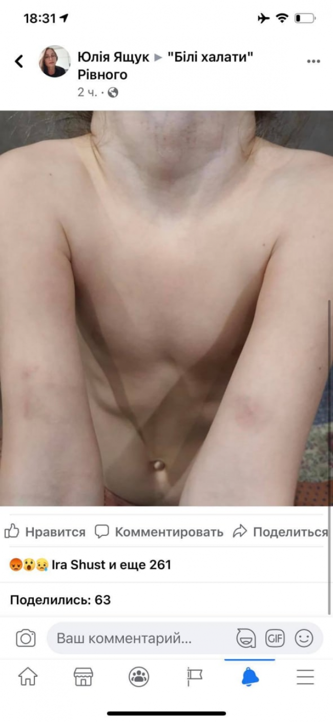 Ребенок после стоматолога. Фото: Вісті Рівненщини