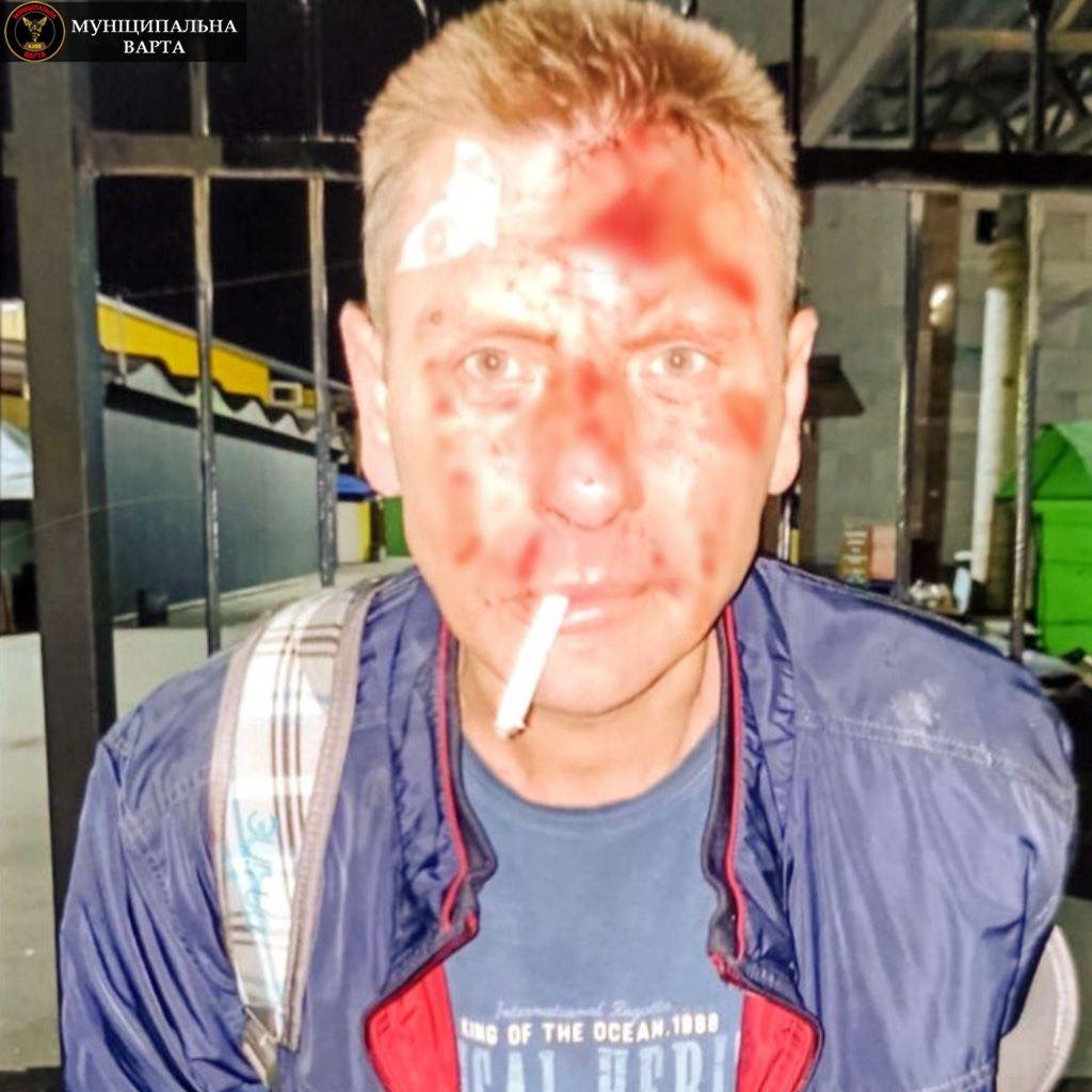 Инцидент в Деснянском районе. Фото: Муніципальна варта