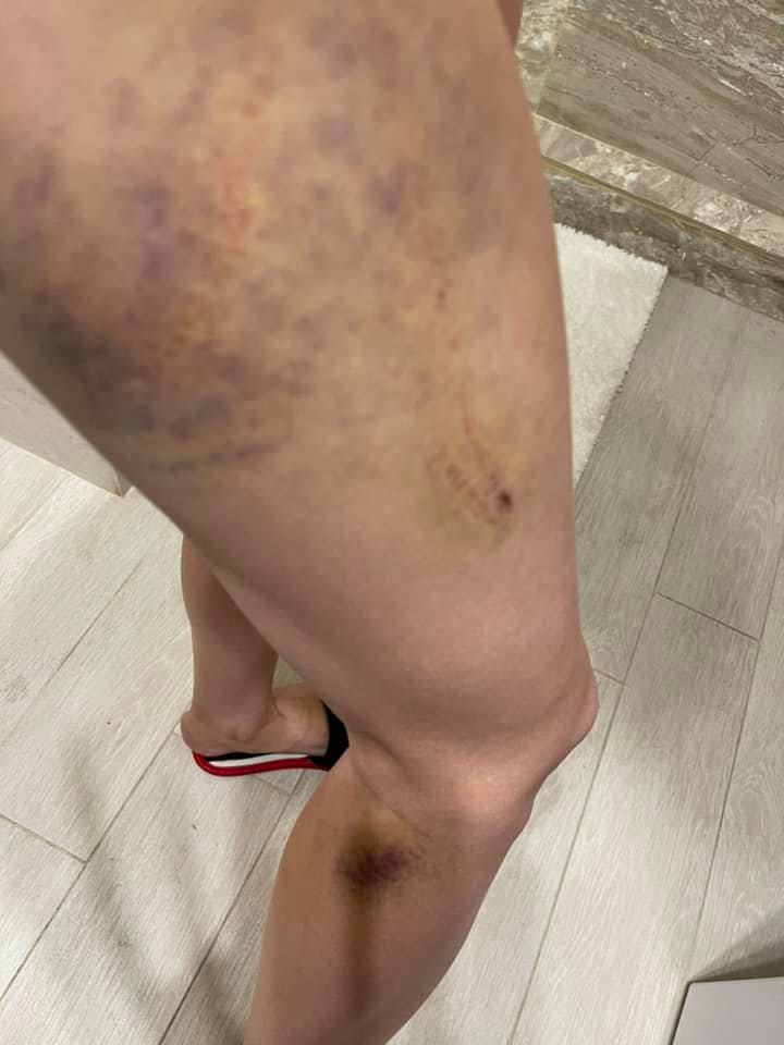 Фото: Facebook/Наталья Дикая